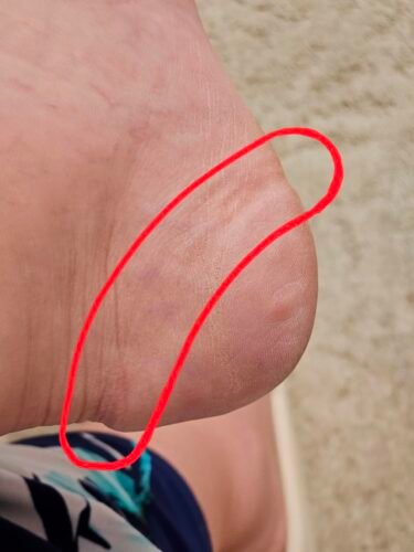 Bodyprox Ankle Support Brace. Breathable Neoprene Sleeve. Adjustable Wrap! (1 Pack) photo review